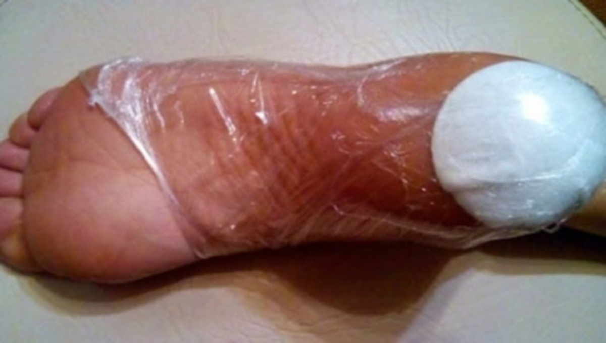 Τυλίγει την φτέρνα της με πλαστική μεμβράνη και κάτι ακόμα – Δείτε τι μοναδικό πετυχαίνει έτσι