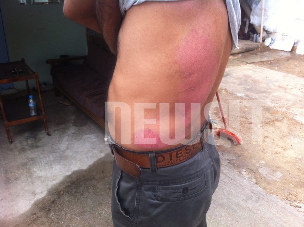 “Πήγαν να με κάψουν ζωντανό” – Συγκλονιστική μαρτυρία μετανάστη στο NEWSIT – ΦΩΤΟ και ΒΙΝΤΕΟ