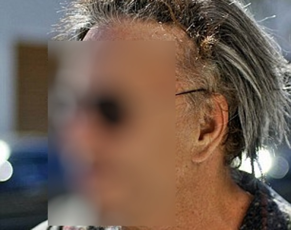 Τεράστια αλλαγή στο πρόσωπο πασίγνωστου ηθοποιού!