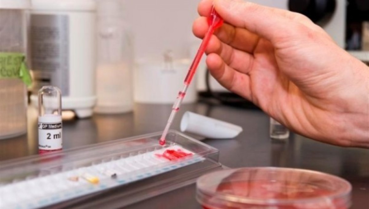 Επιχειρήθηκε τροποποίηση γονιδίων ανθρωπίνων εμβρύων για να μην κολλάνε τον ιό HIV!