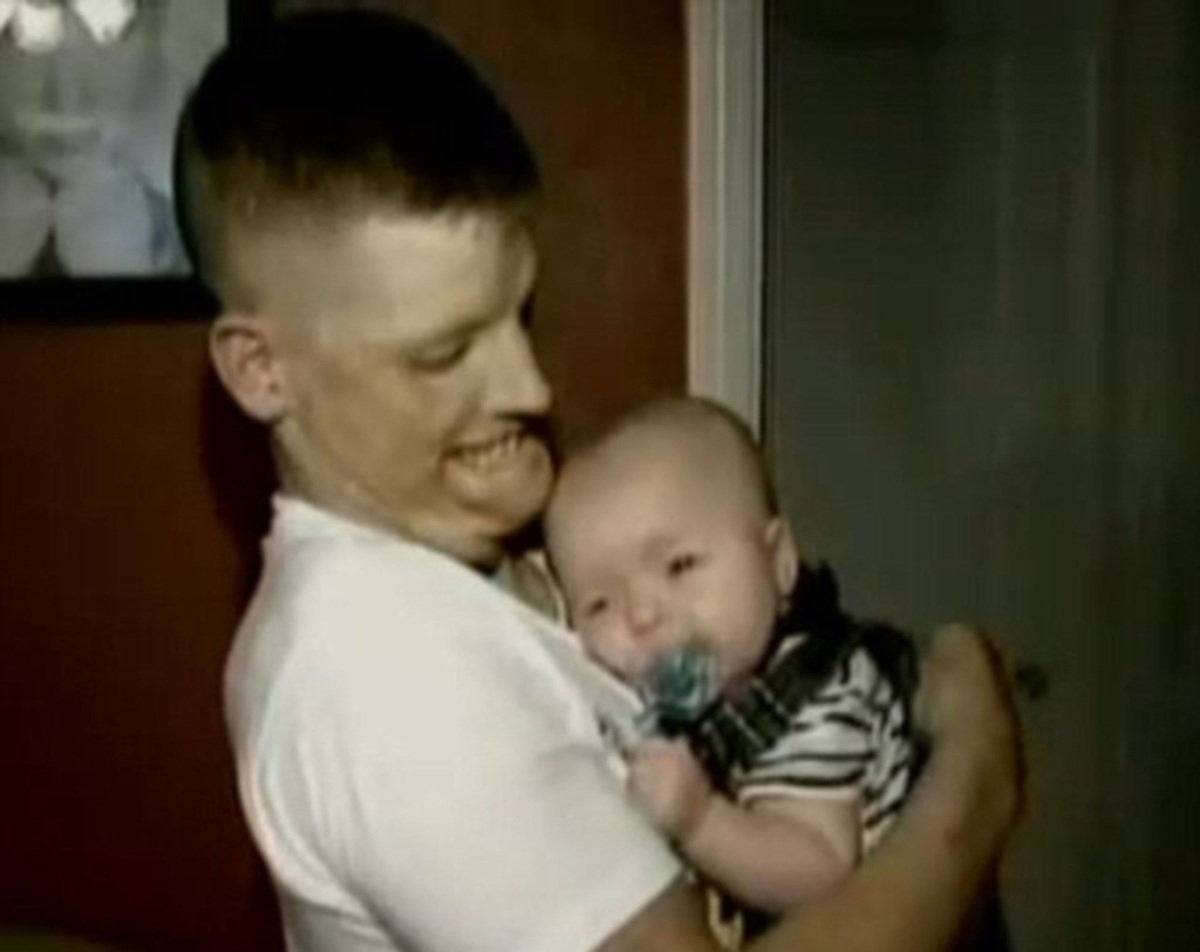 Έκανε μεταμόσχευση προσώπου για να μην τρομάζει το γιο του