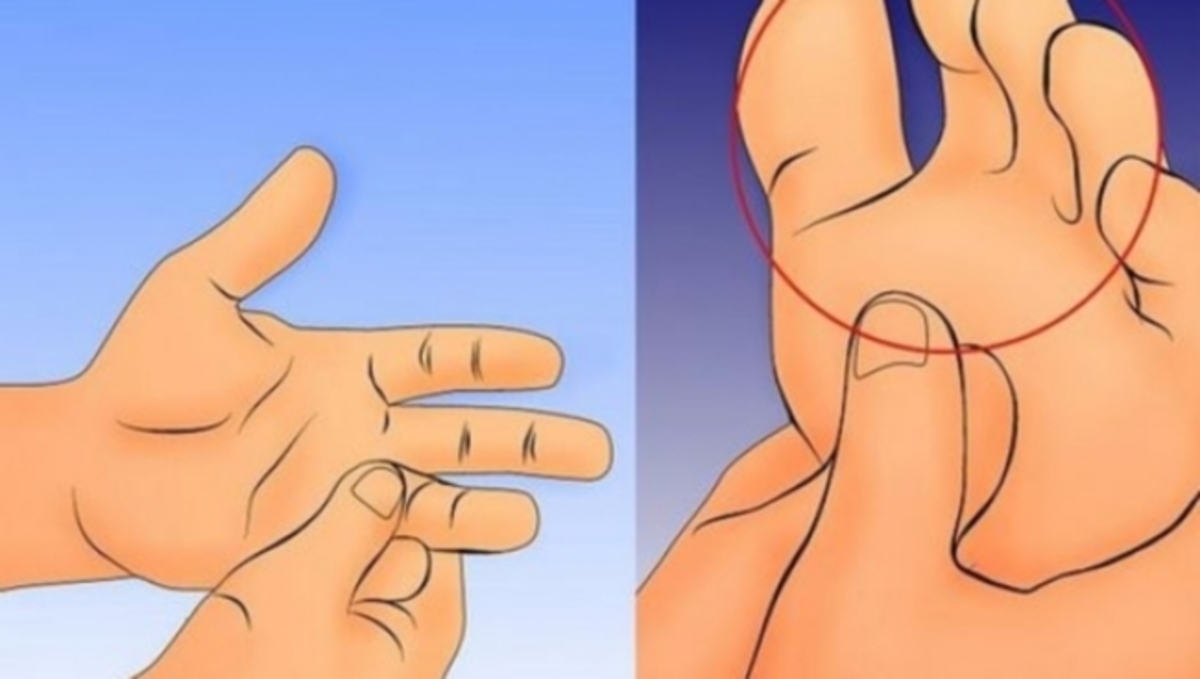 Μουδιάζετε σε χέρια και πόδια; Δείτε τι μπορεί να πάθατε