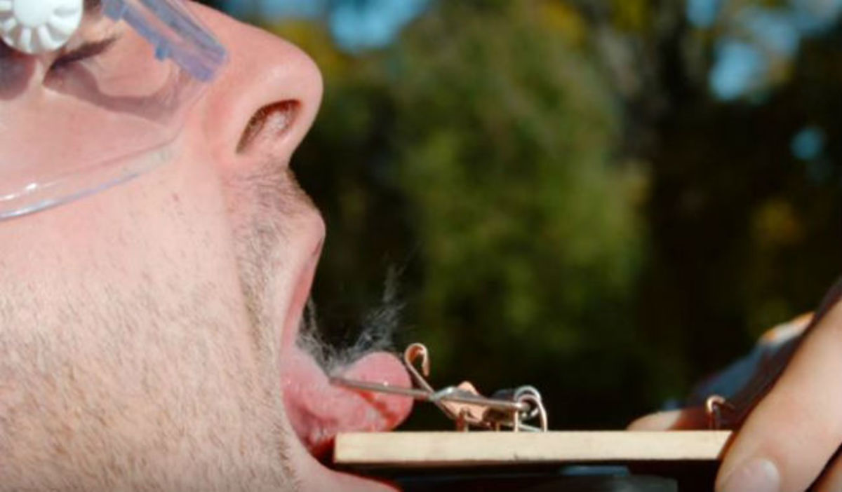 Συγκλονιστικό βίντεο: H γλώσσα αυτού του άνδρα πιάστηκε σε ποντικοπαγίδα!