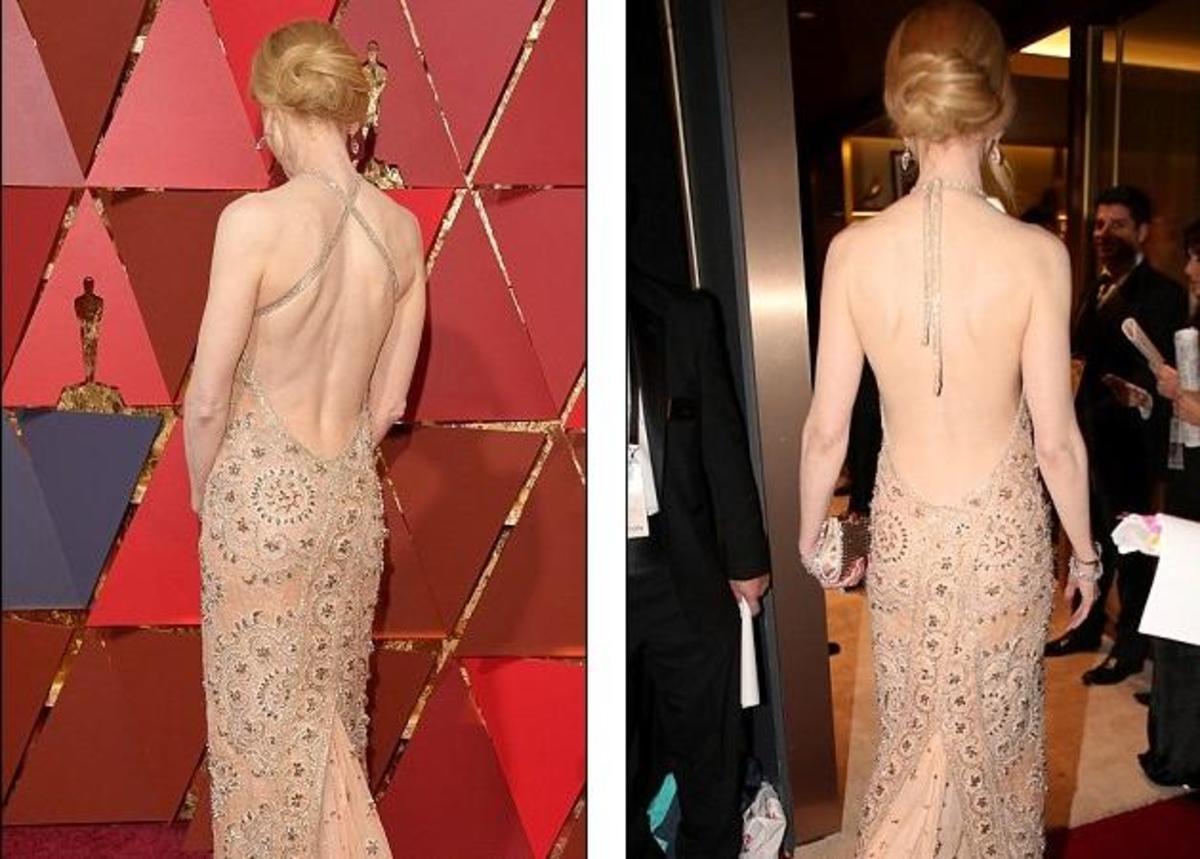 Nicole Kidman: Ο … πανικός της από τα κόκκινα σημάδια που της προκάλεσε το φόρεμά της! Πώς το διόρθωσε; [pics]