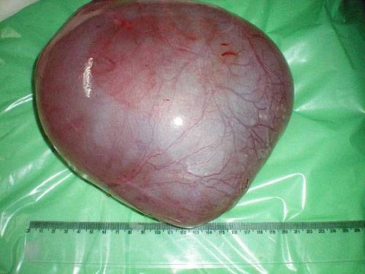 ΦΩΤΟ από politis-news.com