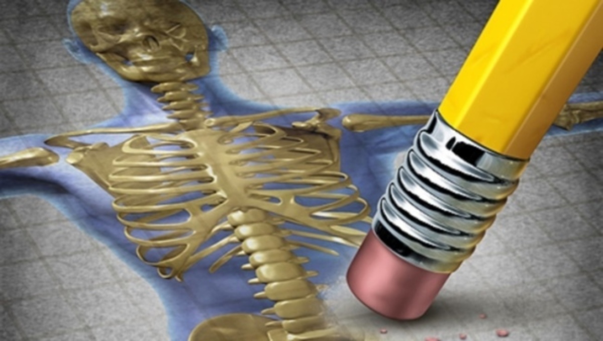 Τρεις απλές αλλαγές στην καθημερινότητά σας για να μην πάθετε οστεοπόρωση