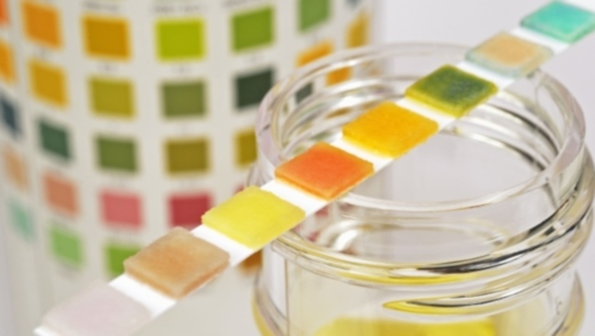 SOS: Τι σας συμβαίνει αν τα ούρα σας δεν είναι κανονικά – Ποιο χρώμα στα ούρα είναι κίνδυνος