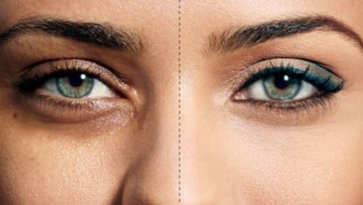 Πώς θα εξαφανίσετε τις ‘σακούλες’ κάτω από τα μάτια – Ποιά φυσικά υλικά πρέπει να βάλετε