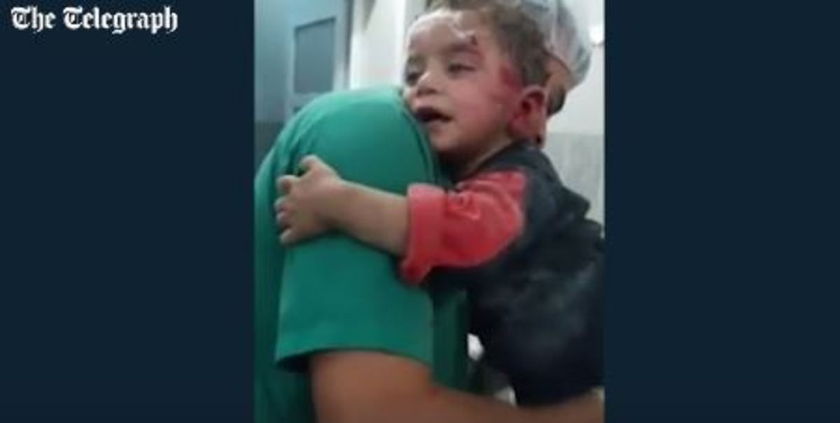 Βίντεο “γροθιά στο στομάχι” από τη Συρία! Τραυματισμένο παιδί αρνείται να φύγει από την αγκαλιά του νοσηλευτή [vid]
