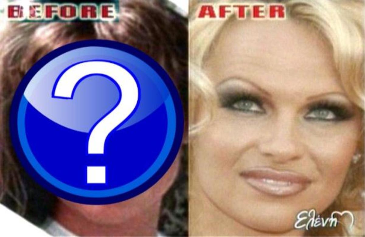 Οι πιο πετυχημένες πλαστικές των διασήμων!