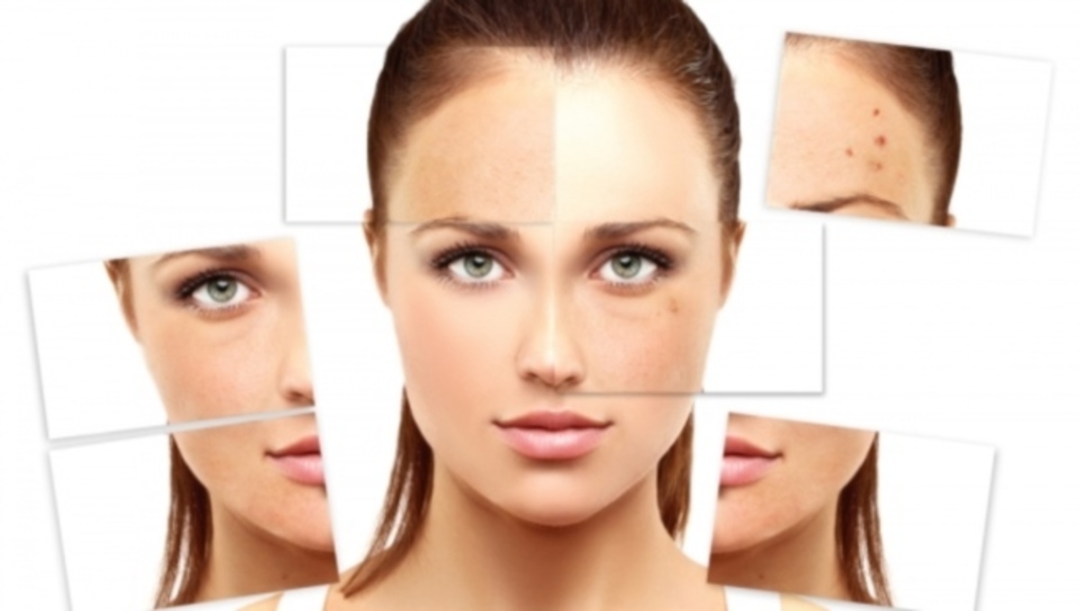 Οι θεραπείες που εξαφανίζουν τις αντιαισθητικές πανάδες από το πρόσωπο