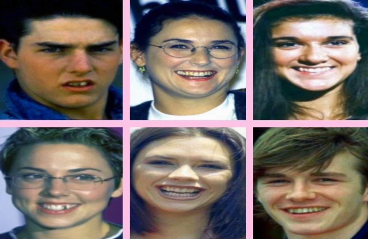 ΔΕΙΤΕ τα χαμόγελα των διάσημων… πριν και μετά!