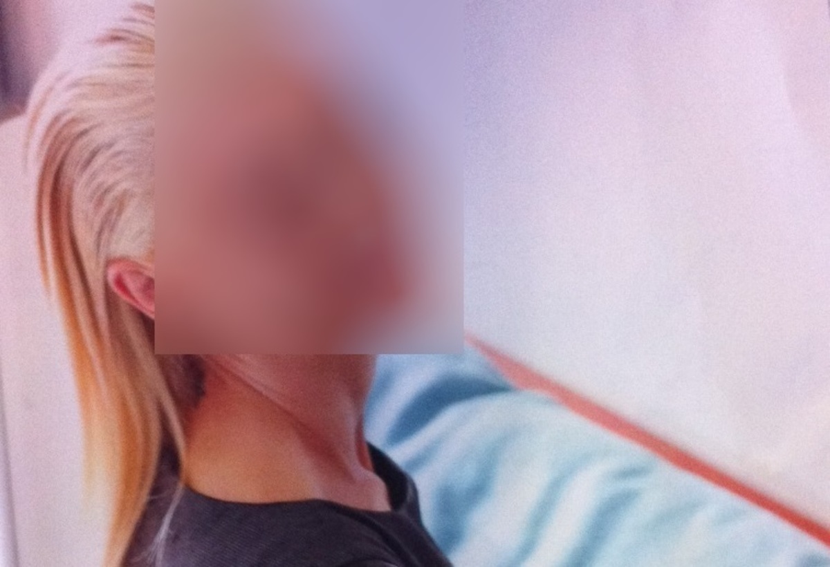 «Η πρώτη πλαστική δεν ήταν καθόλου επιτυχημένη. Ο Φουστάνος μου έκανε τη δεύτερη»