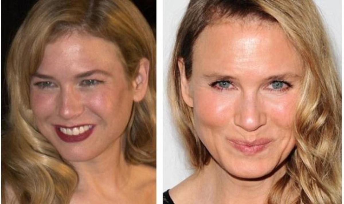 Αυτό είναι το μυστικό της μεταμόρφωσης της Renee Zellweger!