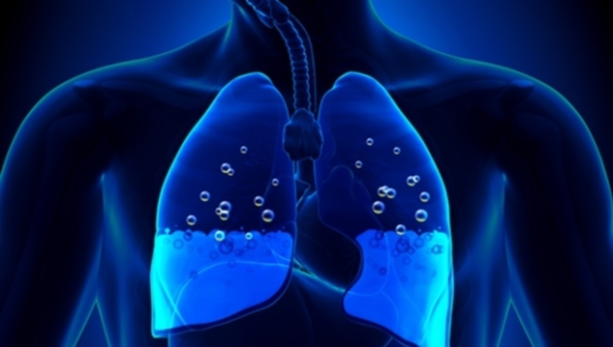 Αν νιώθετε αυτά, μπορεί να έχετε συσσώρευση υγρού στον πνεύμονα!