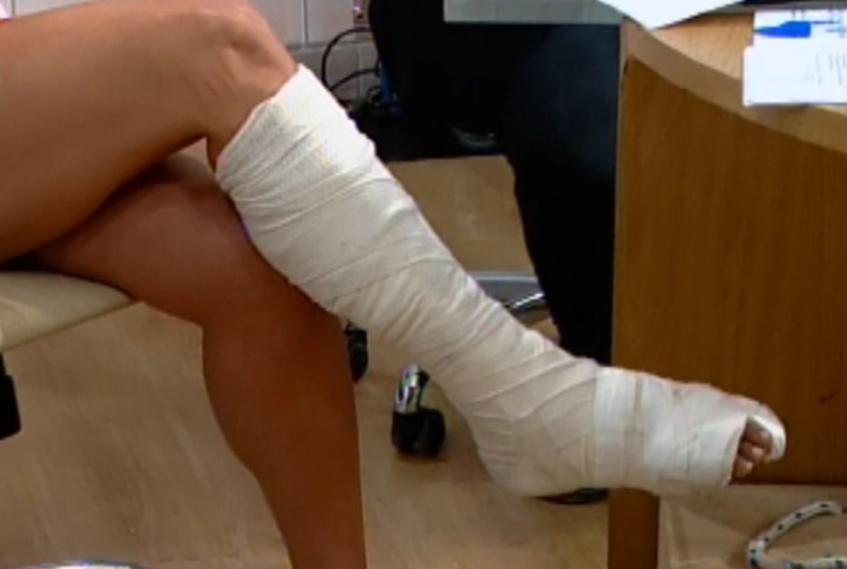 Ποια παρουσιάστρια βγήκε με χτυπημένο πόδι;