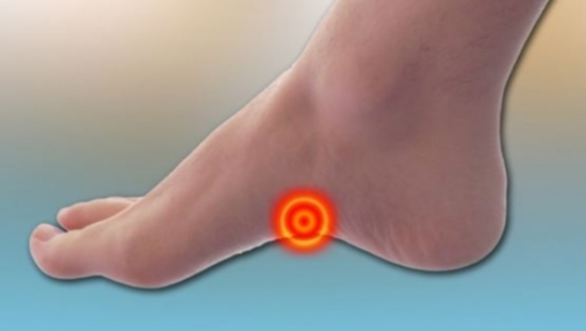 Πώς περνάει ο ενοχλητικός πόνος στην καμάρα του ποδιού