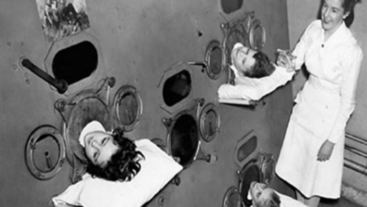 Φωτογραφίες-ΣΟΚ: Απίστευτες ιατρικές πρακτικές από το παρελθόν