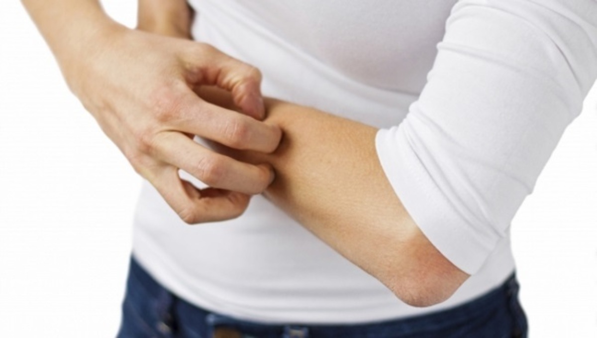 Ψωρίαση: Όσα πρέπει να ξέρετε για τη νόσο για την οποία δεν μιλάει κανείς…