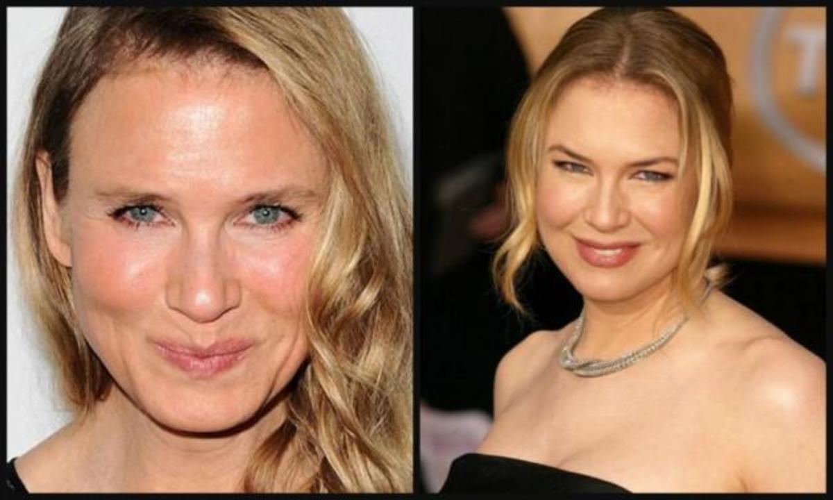 Renee Zellweger: Οι πρώτες φωτογραφίες χωρίς μακιγιάζ με… το νέο της πρόσωπο!