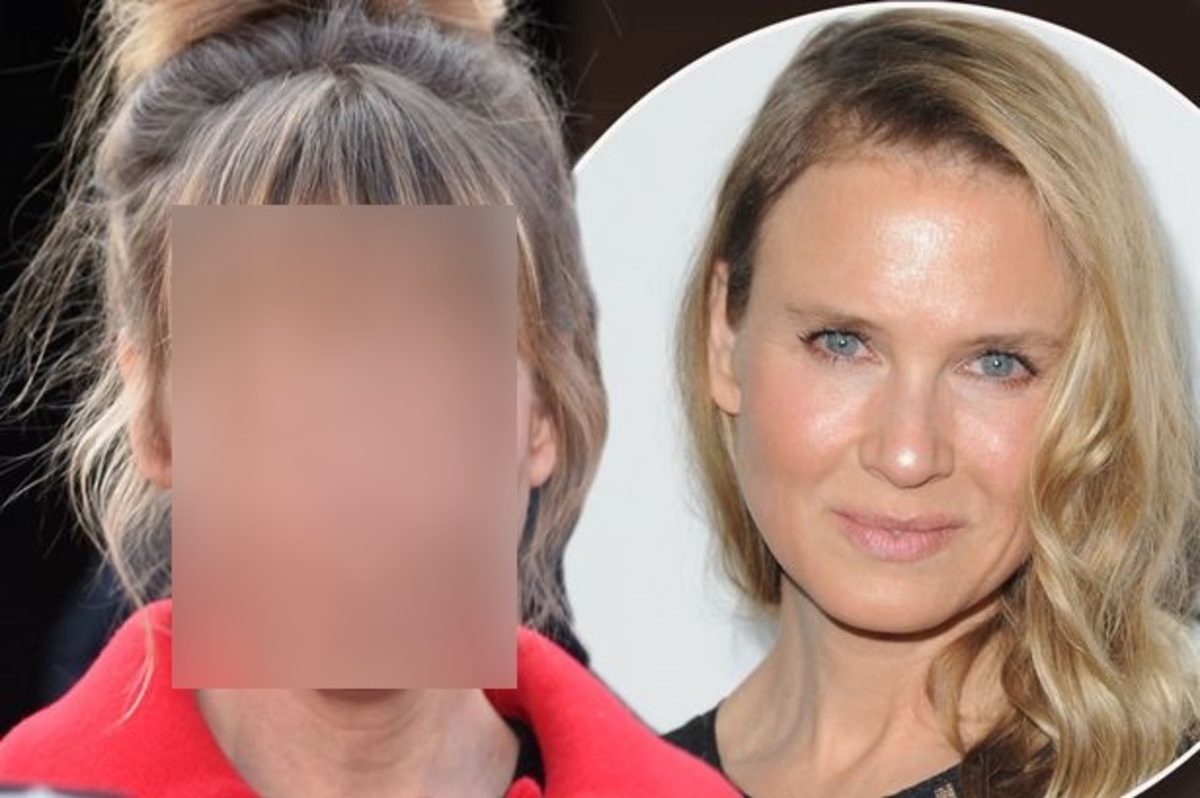 Renee Zellweger: Νέες φωτογραφίες μετά τη σοκαριστική αλλαγή της!