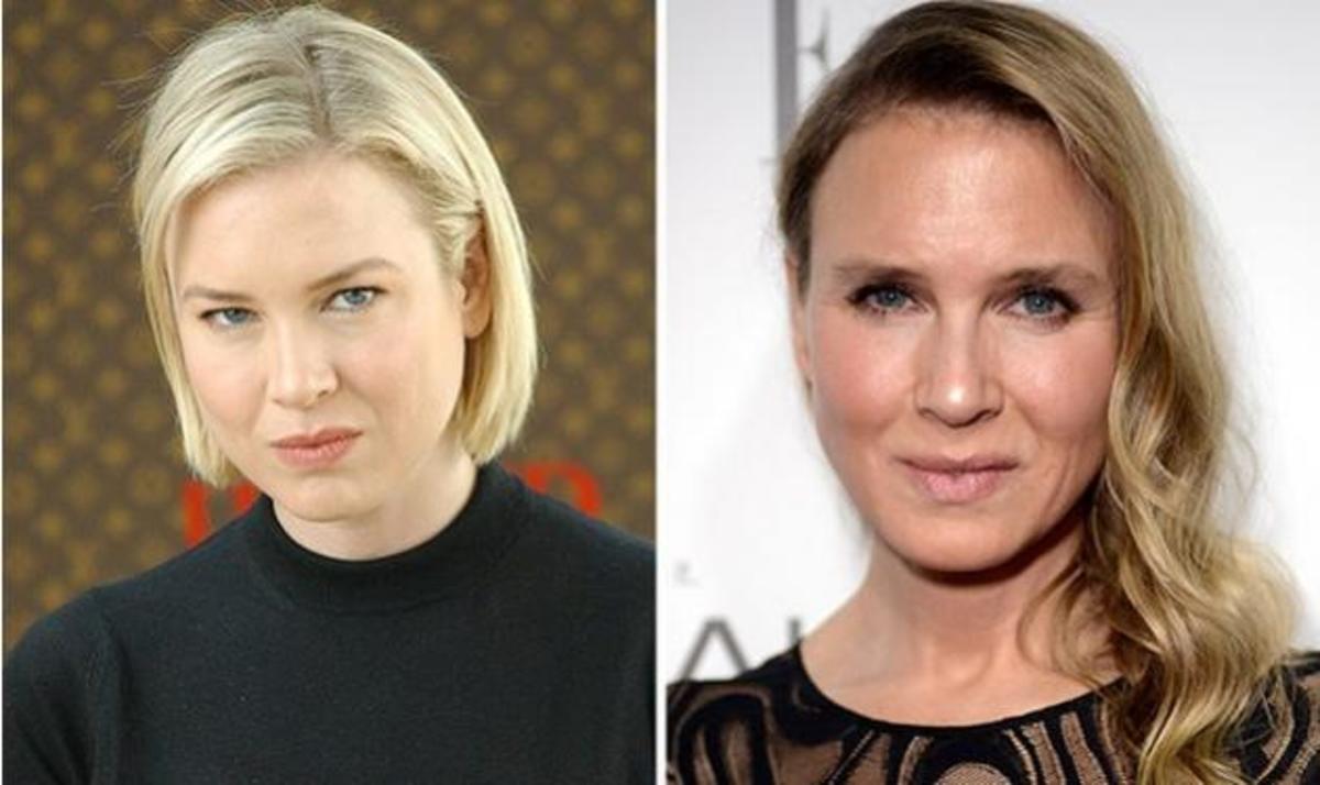 Renee Zellweger: Με άλλο πρόσωπο ξανά η ηθοποιός; Νέες φωτογραφίες