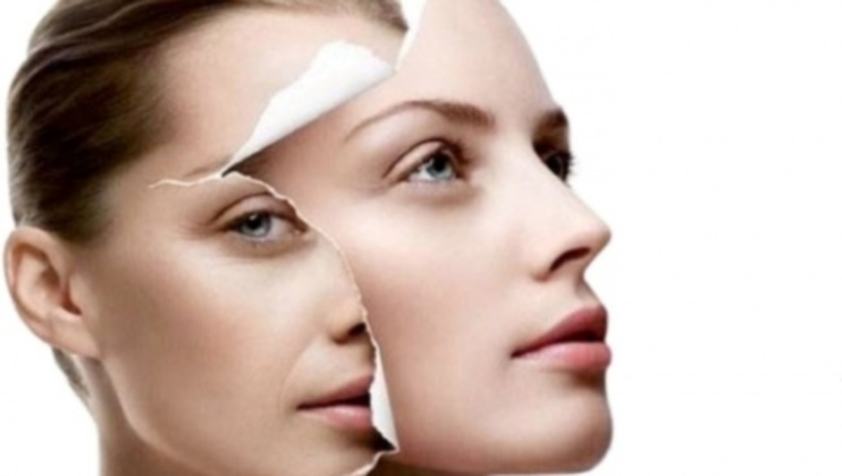 Ποιες είναι οι πιο αποτελεσματικές μέθοδοι για τις ρυτίδες – Πώς τις κατατάσσουν οι δερματολόγοι