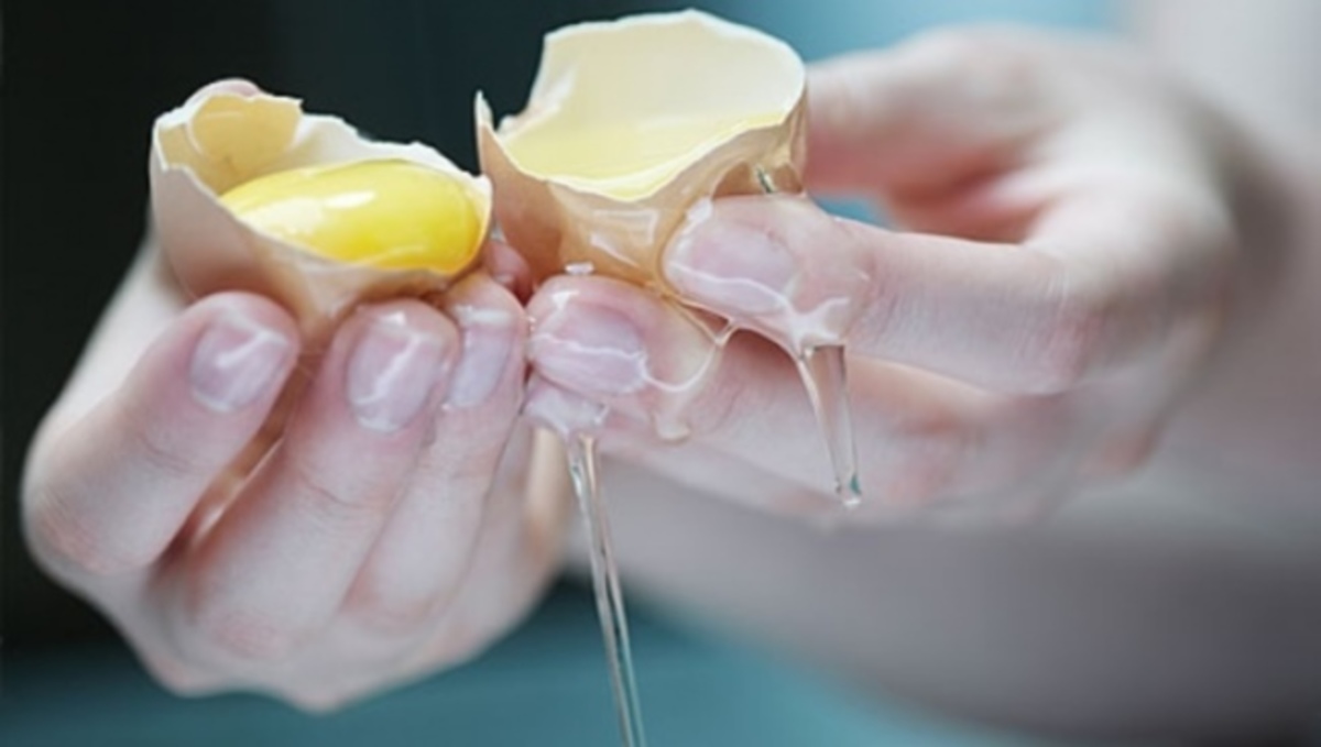 Προσοχή – Αυτά είναι τα συμπτώματα της δηλητηρίασης από σαλμονέλα