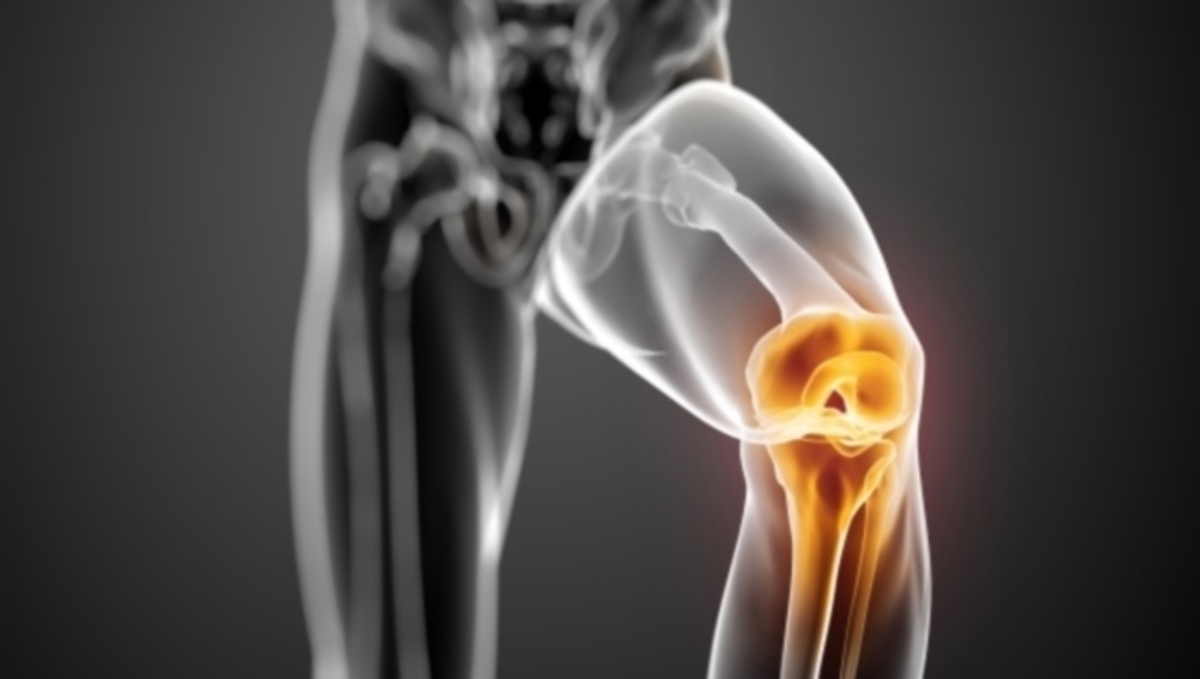 Προσοχή: Τα σημάδια σε δέρμα και αρθρώσεις που δείχνουν σύνδρομο Ehlers-Danlos