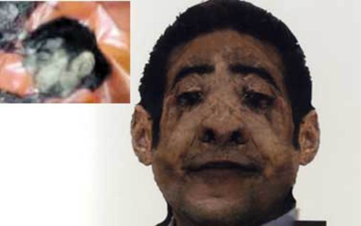 Ποιός ήταν ο δράστης που αιματοκύλισε την Αλεξάνδρεια