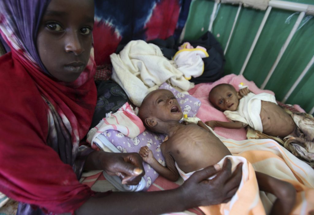 Πεθαίνοντας από την πείνα στην Αφρική – Τα παιδιά θύματα της παγκόσμιας αδιαφορίας – ΣΟΚΑΡΙΣΤΙΚΕΣ ΦΩΤΟ