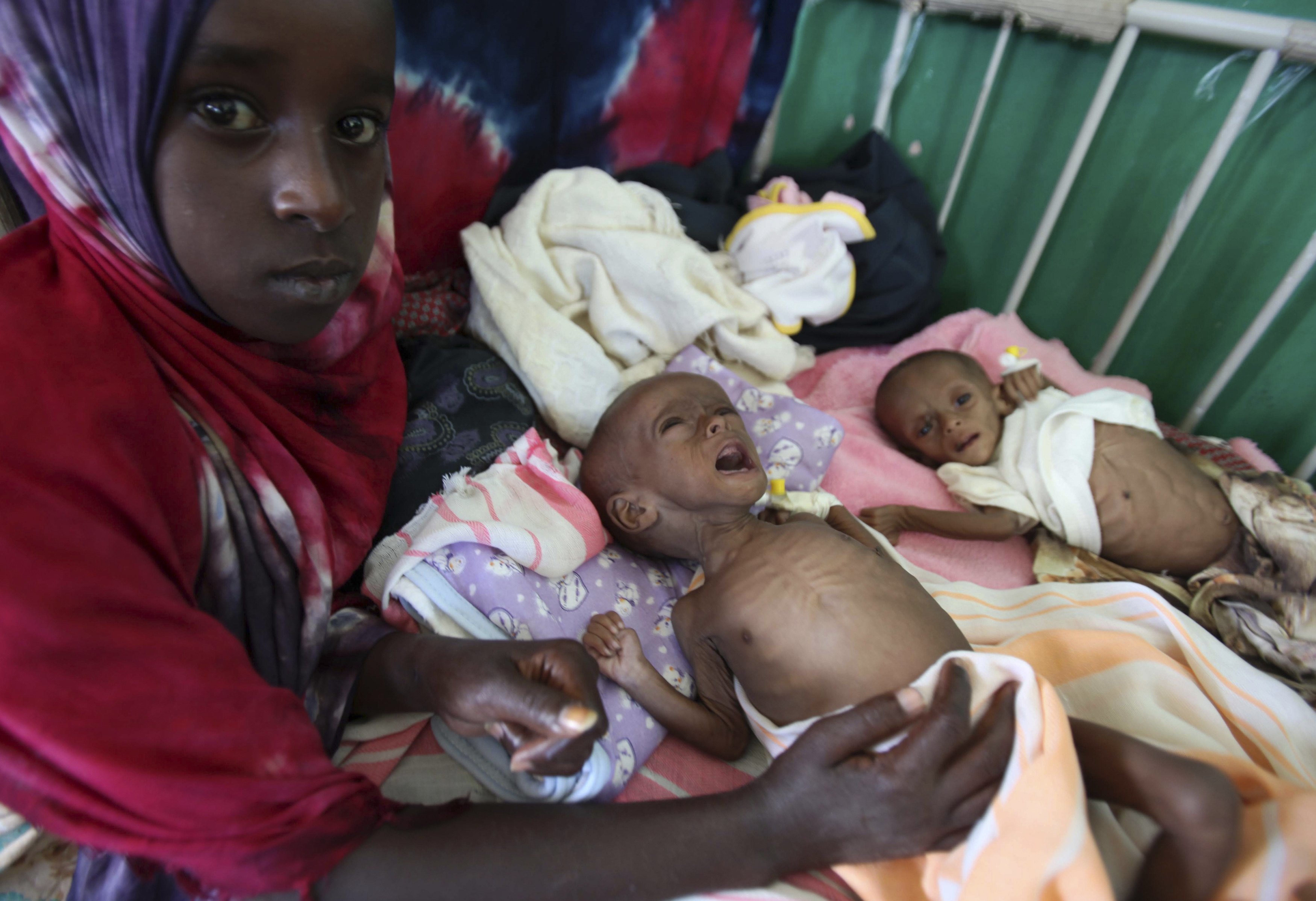 Πεθαίνοντας από την πείνα στην Αφρική – Τα παιδιά θύματα της παγκόσμιας αδιαφορίας – ΣΟΚΑΡΙΣΤΙΚΕΣ ΦΩΤΟ