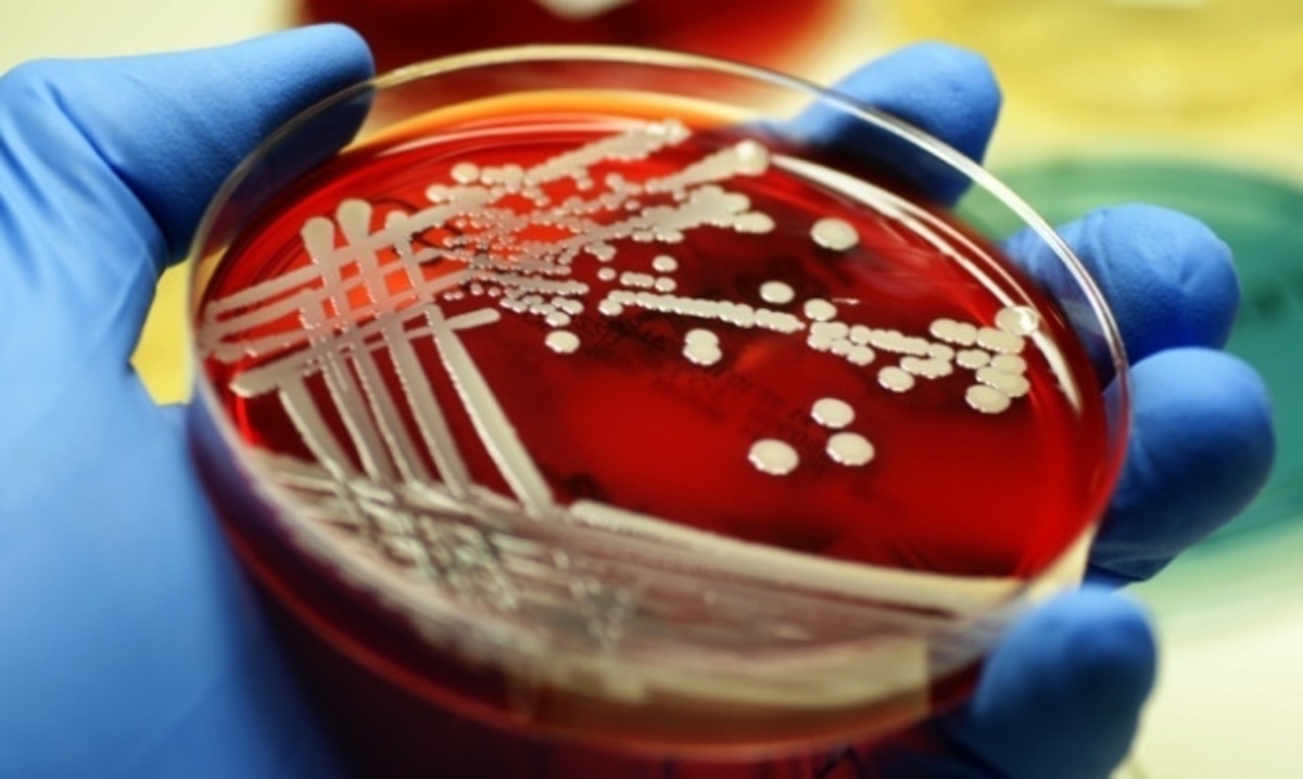 Μεγάλη προσοχή στα σημάδια του σταφυλόκοκκου: Πώς φαίνονται και τι πρέπει να ξέρετε