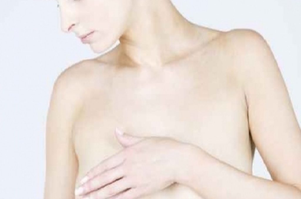 Πώς γίνεται η αυτοεξέταση του μαστού;