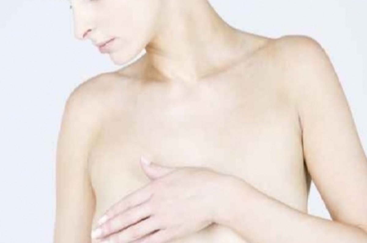 Πώς γίνεται η αυτοεξέταση του μαστού;