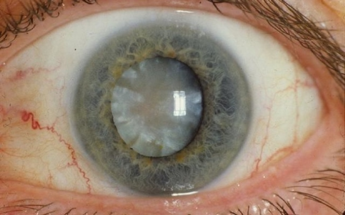 Τα 7 “θαύματα” που έδωσαν ελπίδα στον κόσμο το 2015