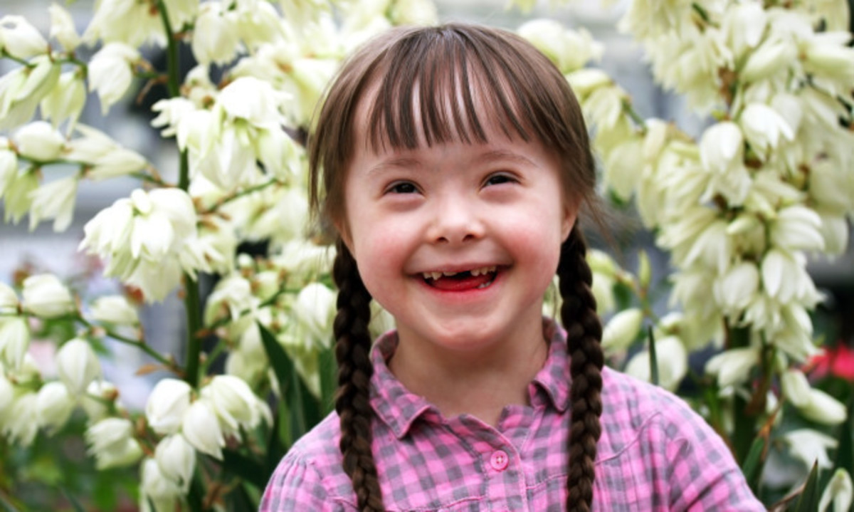 Παγκόσμια Ημέρα Συνδρόμου Down: Ίσοι προς ίσους στα πάντα – Τι είναι η ασθένεια (ΒΙΝΤΕΟ)