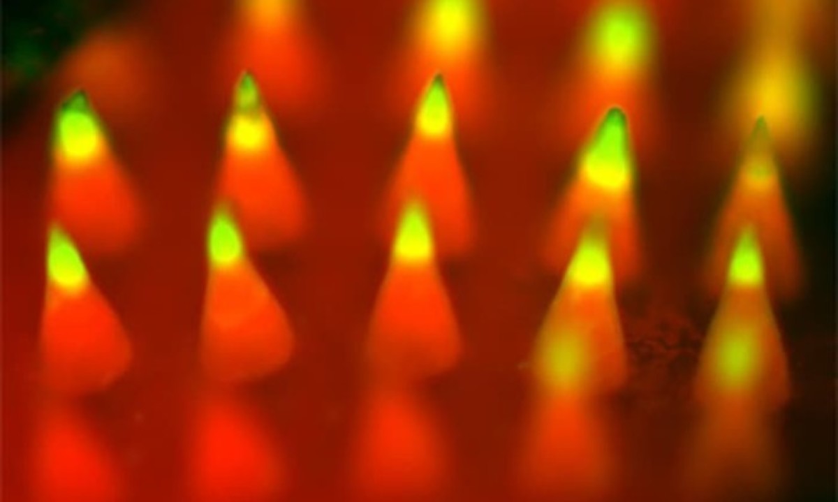 Μελάνωμα: Νέα μέθοδος θεραπείας με «έξυπνο τσιρότο» (γράφημα)