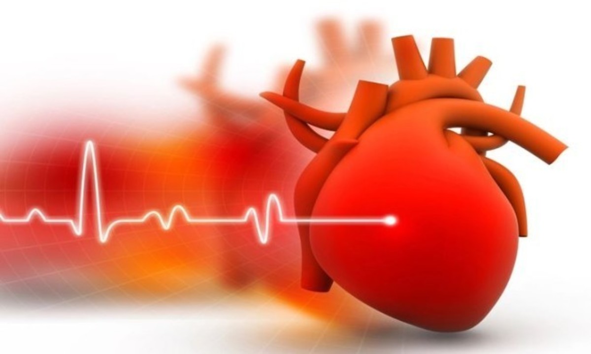 Υπέρταση: Πότε υπάρχει προϋπέρταση και πότε Στάδιο 1 και Στάδιο 2 υπέρτασης