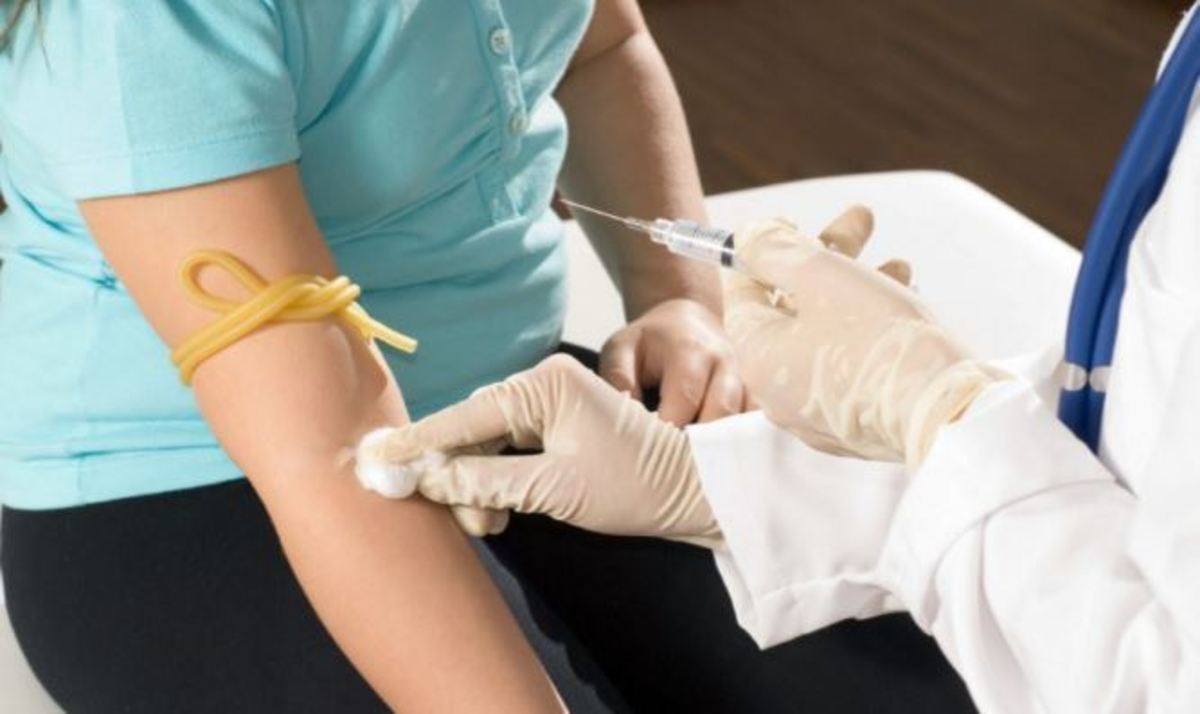 Εξετάσεις για χοληστερίνη: ΔΕΝ είναι ανάγκη να πάτε με άδειο στομάχι – Τι λένε οι επιστήμονες