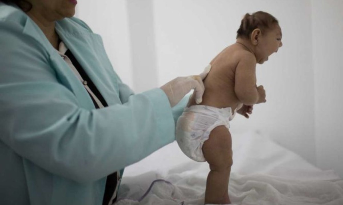 Ζίκα: Ανησυχία ότι μπορεί να προκαλεί Αλτσχάιμερ!