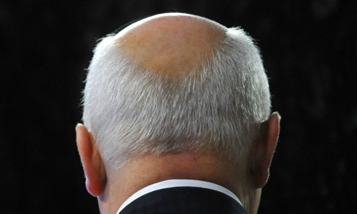 Δημιούργησαν τεχνητό δέρμα που βγάζει τρίχες και ιδρώνει! (BINTEO)