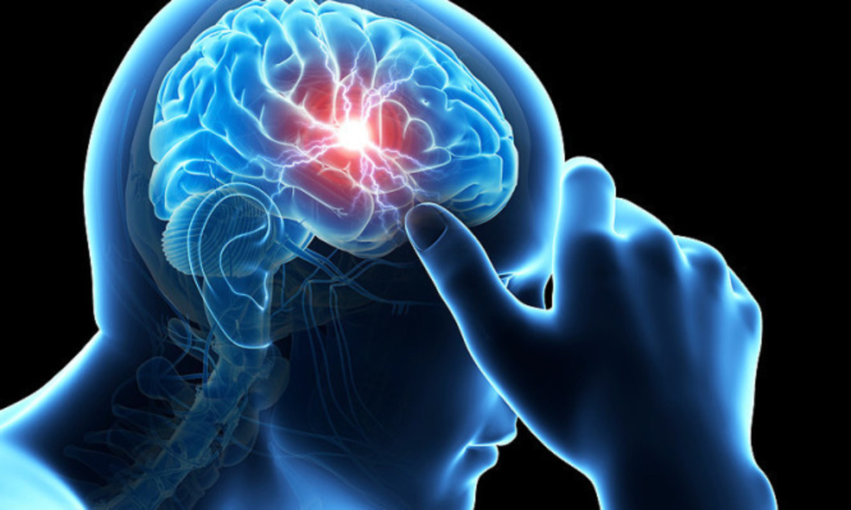 Διάσειση: Τα συμπτώματα που πρέπει ΟΛΟΙ να γνωρίζουν – Τι να κάνετε άμεσα