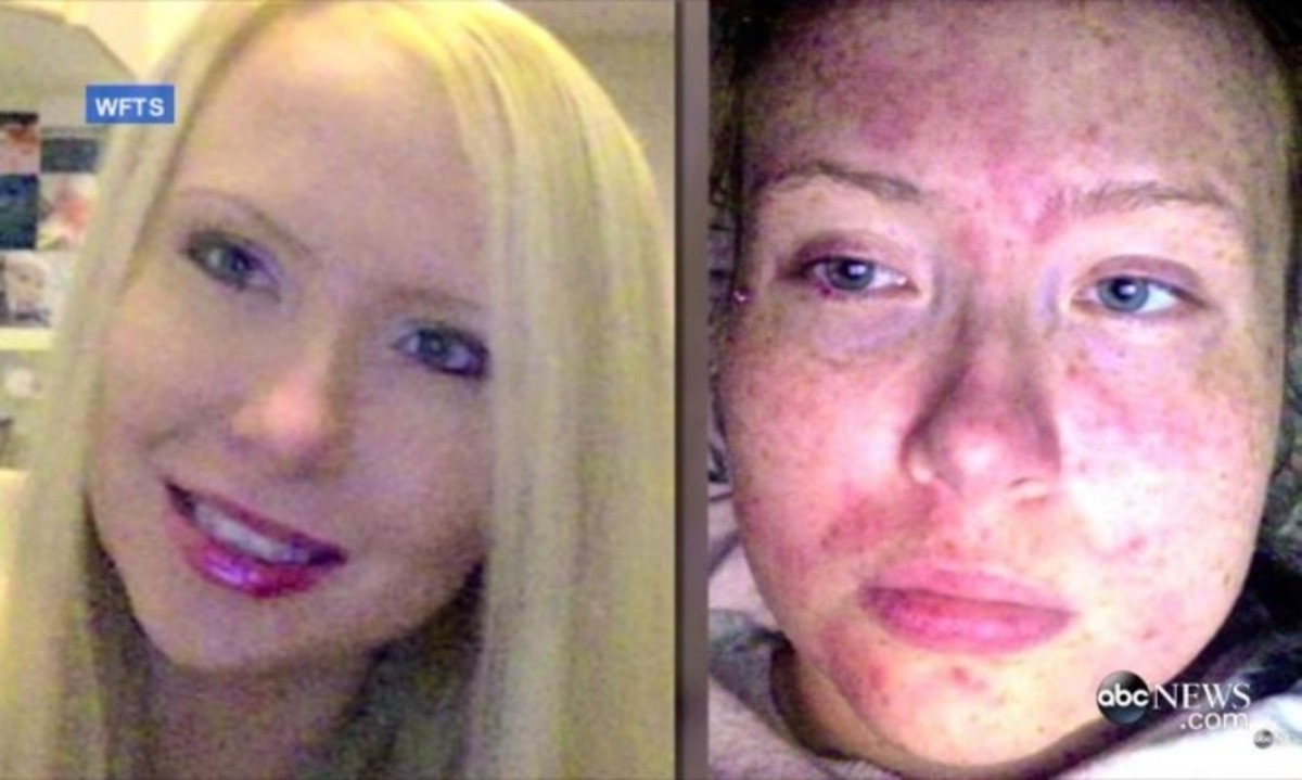 Δείτε τι παθαίνει από τον ίδιο της τον ιδρώτα και τα δάκρυα – Ανατριχιαστικό ΒΙΝΤΕΟ