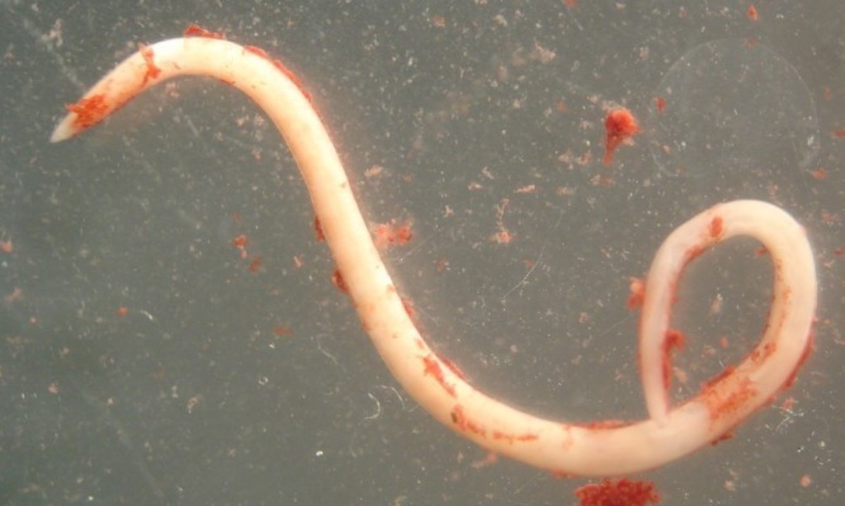 Προσοχή: Τα 10 σημάδια που δείχνουν ότι έχετε παράσιτα στο έντερο