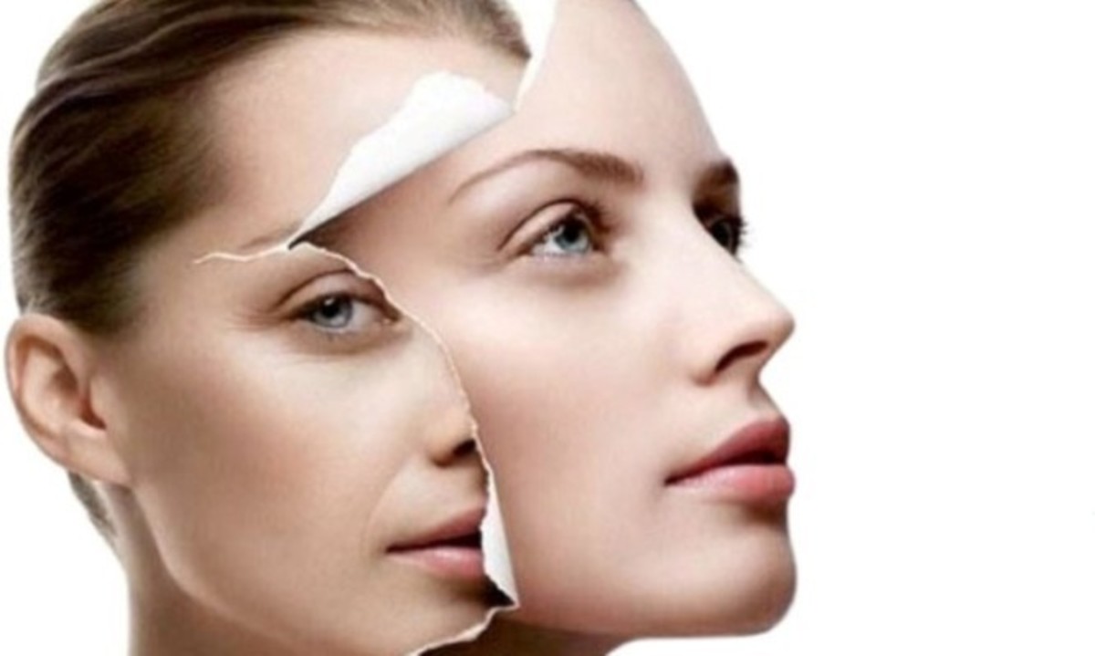 Ρυτίδες: 3 μέθοδοι απομάκρυνσης με σειρά αποτελεσματικότητας