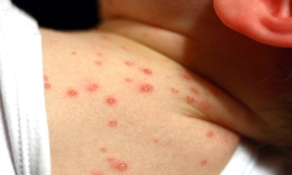 Τι πρέπει να ξέρει κάθε γονιός για την ανεμοβλογιά