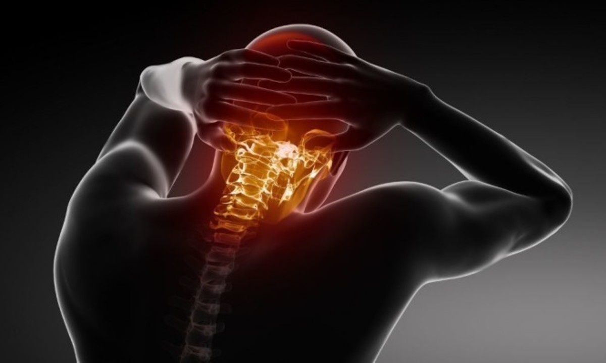 Αυχενικό σύνδρομο: Ασκήσεις για ανακούφιση και θεραπεία (φωτό + βίντεο)