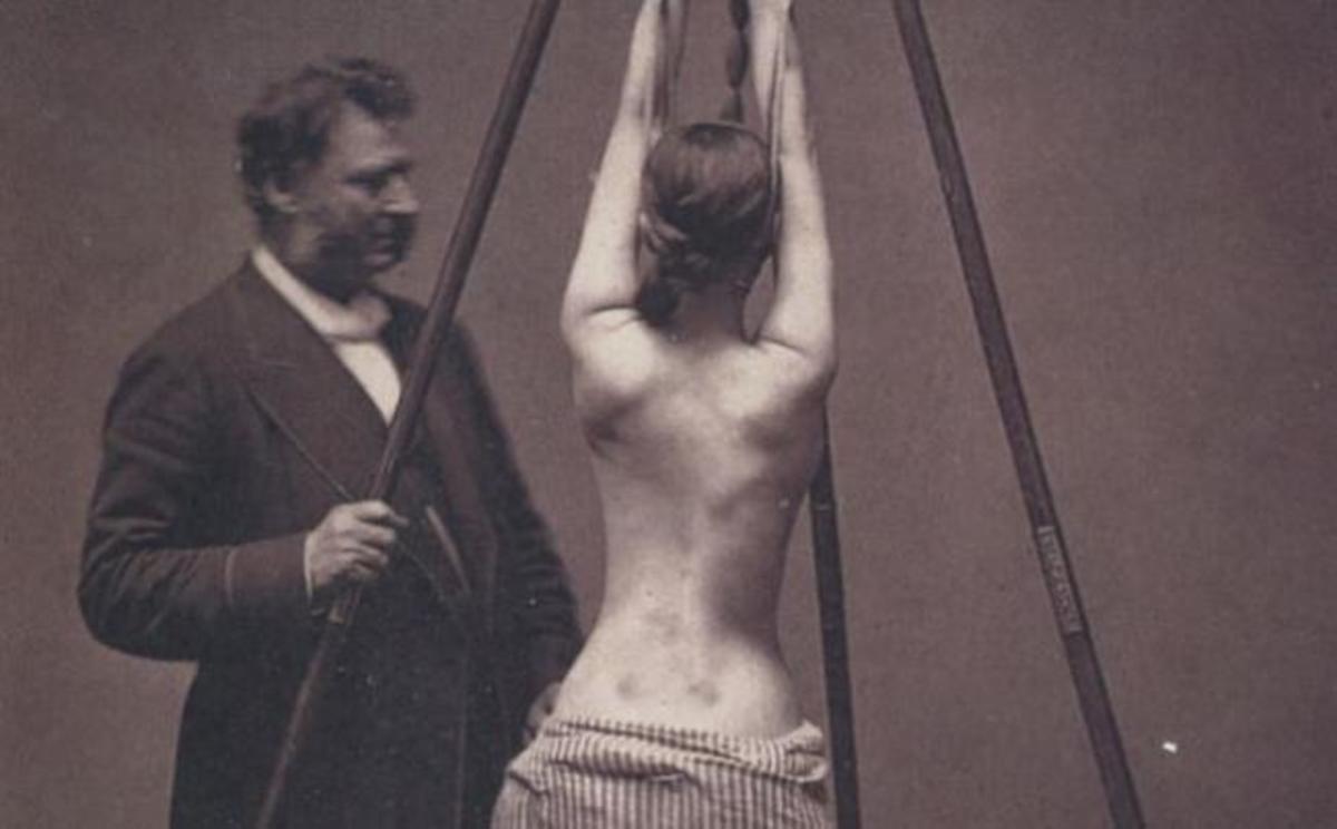 Ανατριχιαστικό βίντεο με ιατρικές πρακτικές πριν από έναν αιώνα – Εικόνες ΣΟΚ