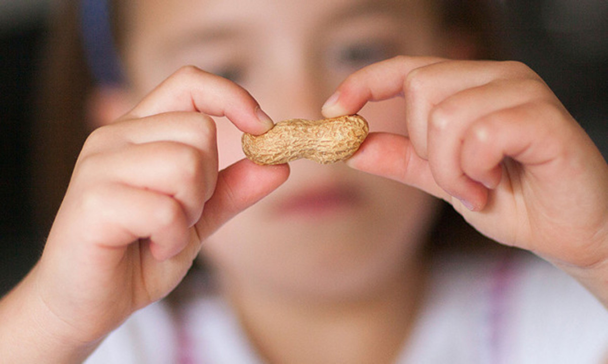 Διατροφικές αλλεργίες: Πώς αντιμετωπίζονται από την παιδική ηλικία